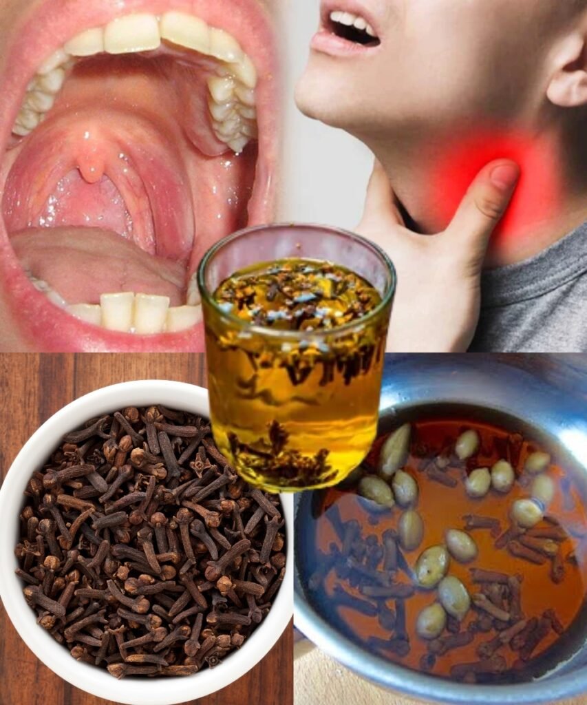 Kills Sore Throat and Inflammation – Cloves: Nature’s Antibiotic! 🌿🧄✨