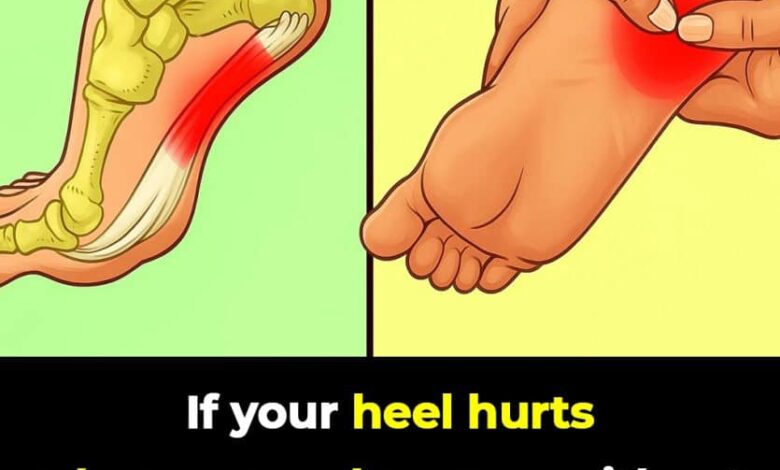 7 Powerful Exercises to Relieve Heel Pain and Treat Plantar Fasciitis Naturally