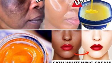 The Best Way to Use Vaseline and Lemon on Skin for Dark Spots, Wrinkles, and a Natural Glow (Safely!)