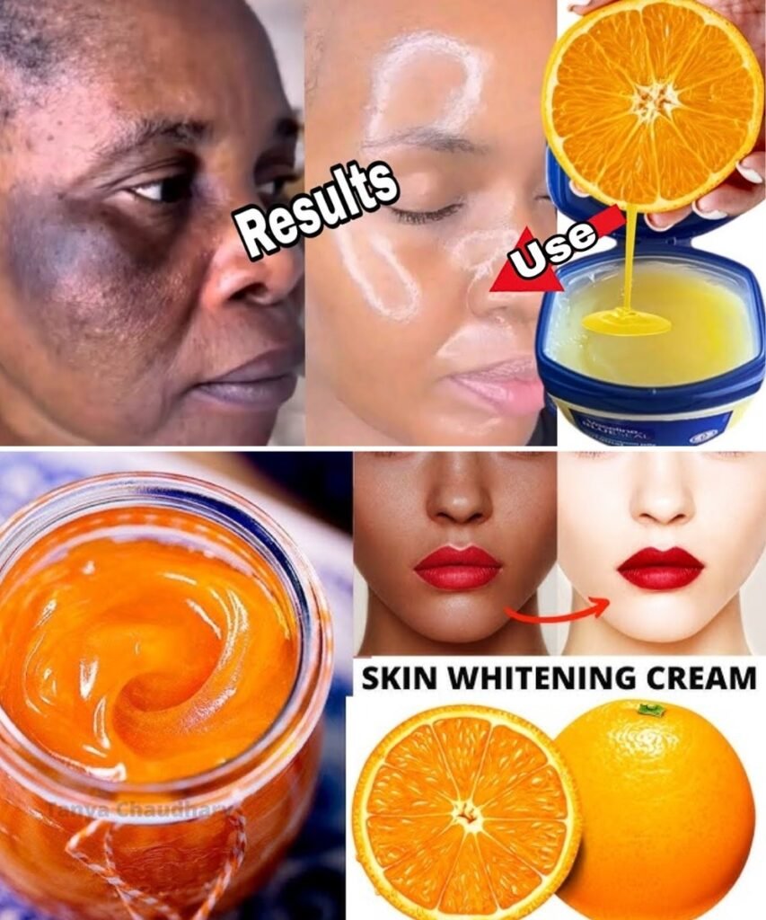 The Best Way to Use Vaseline and Lemon on Skin for Dark Spots, Wrinkles, and a Natural Glow (Safely!)