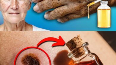 Apply Just 1 Drop: Natural Oil Remedy to Erase Age Spots Forever