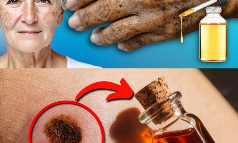 Apply Just 1 Drop: Natural Oil Remedy to Erase Age Spots Forever