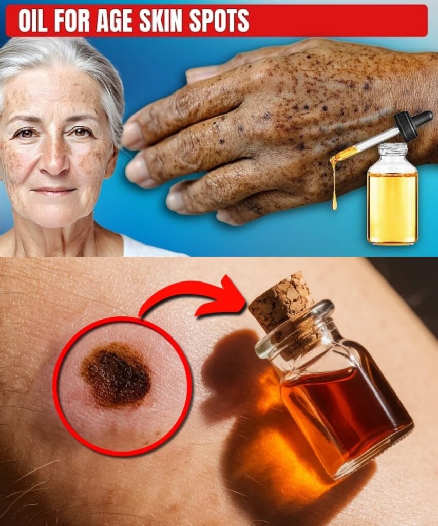 Apply Just 1 Drop: Natural Oil Remedy to Erase Age Spots Forever