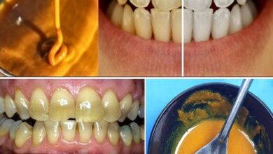 Homemade Toothpaste to Whiten Teeth & Reverse Gum Disease Using Turmeric, Coconut Oil & Peppermint